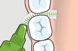 How to use Interdental Brush